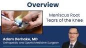 Meniscus Root Tears of the Knee: Overview
