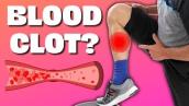 Is Your Calf Pain a Blood Clot!? Do Homan