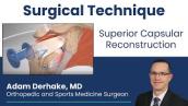 Superior Capsular Reconstruction of the Shoulder (SCR):  Surgical Technique