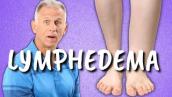 10 Exercises for Leg Lymphedema (Swelling or Edema of the Lower Extremities)