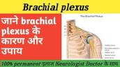 brachial plexus । brachial plexus nerve treatment । brachial plexus injury । brachial plexus tcml