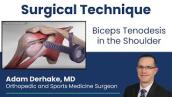 Biceps Tenodesis in the Shoulder: Surgical Technique