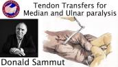 Tendon Transfers Median and Ulnar Paralysis - Indications and Techniques