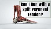 Can I Run with a Split Peroneal Tendon