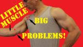 Pronator Teres - Little Muscle, Big Problems!