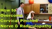 How To Overcome Cervical Pinched Nerve And Radiculopathy. \