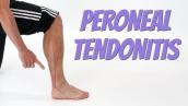 Peroneal Tendonitis (Side of Foot Pain), Causes \u0026 Self-Treatment.