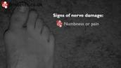 Checking Your Feet For Signs of Nerve Damage