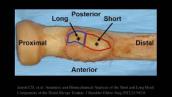 Distal Biceps Tendon Anatomic Repair