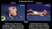 6 Month Old Baby Typical \u0026 Atypical Development Side by Side