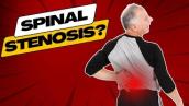 Top 3 Symptoms of Spinal Stenosis