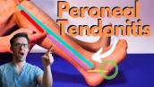 Peroneal Tendonitis Treatment 2021 [Peroneus Brevis \u0026 Longus Pain!]