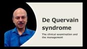 de Quervain syndrome: The clinical examination and the management