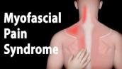 Myofascial Pain Syndrome and Trigger Points Treatments, Animation.
