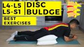 L4 L5 - L5 S1 disc bulge best exercise rehabilitation for pain relief
