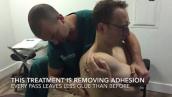 Removing Adhesion from the Upper Back [Back Pain Treatment in Denville, NJ]