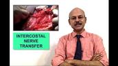 Intercostal Nerve transfer (Surgery for brachial plexus) - 2020