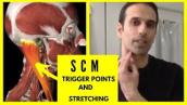Dizziness, headaches, and neck pain from SCM trigger points