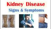 Kidney (Renal) Disease Signs \u0026 Symptoms (ex. Peripheral Edema, Fatigue, Itchiness)
