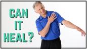 Can I Heal My Torn Rotator Cuff, Science Shows Positive Results Without Surgery, MUST See!