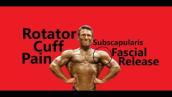 Rotator Cuff Pain - Subscapularis Fascial Release