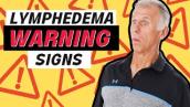 3 Warning Signs Of Lymphedema