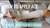 HOW TO APPLY ACE WRAP FOR VENOUS INSUFFICIENCY ULCERS/EDEMA | #woundcarewednesday | Fromcnatonp