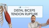 Distal Biceps Tendon Rupture | Expert Physio Review