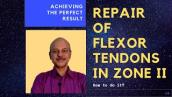 #flexortendon Repair of flexor tendons in Zone II - Understanding the surgical technique!