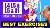 L4 L5 \u0026 L5 S1 Disc Bulge, Best Exercises Rehab For Relief