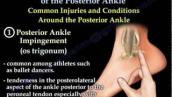 Ankle Pain Complete Overview - Everything You Need To Know - Dr. Nabil Ebraheim