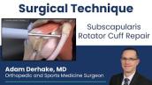 Subscapularis Rotator Cuff Repair:  Surgical Technique