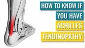 How to Know whether you Have Achilles Tendinopathy - Diagnosis