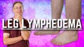 Top 3 Exercises for Leg Lymphedema (Swelling or Edema)