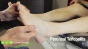Peroneal Tendonitis: Causes, Diagnosis, and Treatment