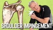 Is Your Shoulder Pain an Impingement? 4 Quick Tests You Can Try.