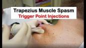 Trapezius Muscle Spasm Trigger Point Injection