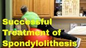 Successful Spondylolisthesis Treatment Without Surgery-Live Active \u0026 Pain-Free