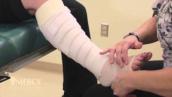 Multi-layer bandaging for the leg