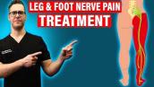 Peripheral Neuropathy Home Remedies [Leg \u0026 Foot Nerve Pain Treatment]