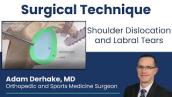 Labral Repair of the Shoulder: Surgical Technique