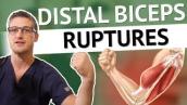 Distal Biceps Ruptures and why they happen in combat sports (and how we fix them)