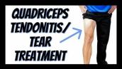 Quadriceps Tendonitis or Tear: Single Best Treatment You Can Do Yourself (Updated)
