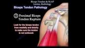 Biceps Tendon \u0026 SLAP Lesion Radiology - Everything You Need To Know - Dr. Nabil Ebraheim