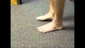 Severe ankle sprain - painfree running and jumping after 4 treatments .mp4