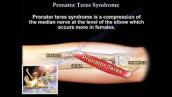 Pronator Teres Syndrome - Everything You Need To Know - Dr. Nabil Ebraheim