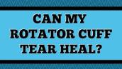 Can My Rotator Cuff Tear Heal?