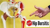STOP Hip Bursitis Pain Without Seeing A Dr  or Having Injection
