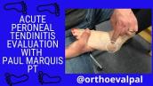 Acute Peroneal Tendinitis Evaluation with @OrthoEvalPal