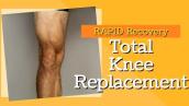 2 Key Exercises to Rapid Recovery for Total Knee Replacement